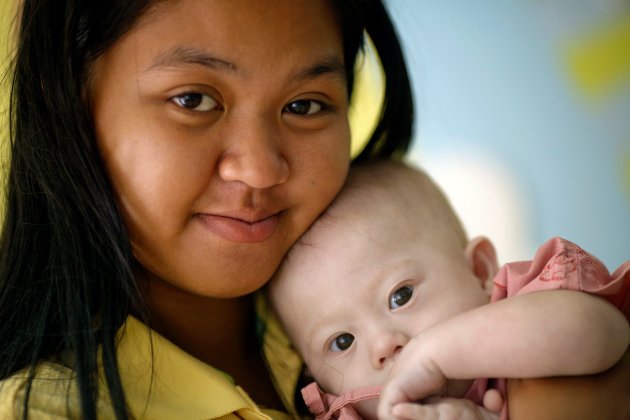 Gammy, el bebé con síndrome de Down, supuestamente rechazado por su padre biológico (Foto Reuters)