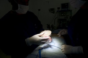 Garantizan atención médica a afectadas por implantes que estén inscritas en el Registro Nacional PIP