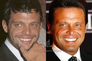INCREÍBLE: El antes y el después de la dentadura de los famosos (Fotos)