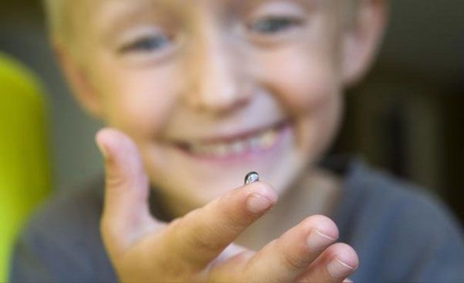 Nació caracol marino en la rodilla de un niño de cuatro años