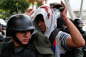 Amnistía Internacional: La tortura es habitual en Venezuela