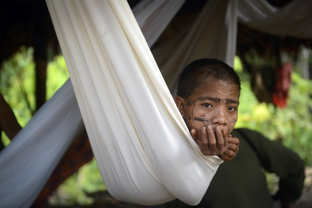 Devastadora epidemia de sarampión azota a indígenas yanomami (Fotos)