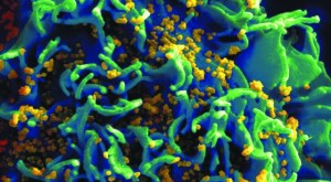 Investigadores identifican molécula utilizada contra el cáncer de piel, que podría acabar con restos de VIH