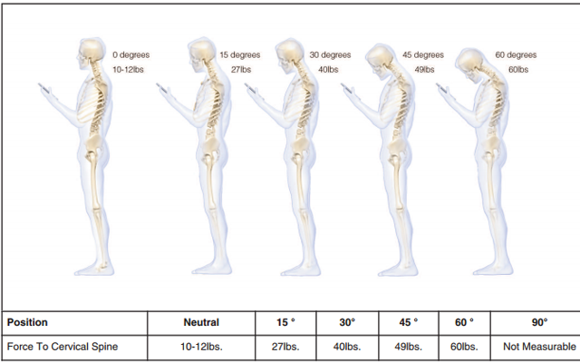 ¿Le duele la espalda? Puede ser por su celular, que le causa daño a su cervical