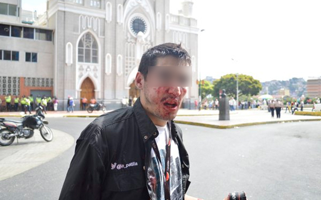 “Colectivos de paz” atacaron y golpearon a periodista de La Patilla (fotos y videos)