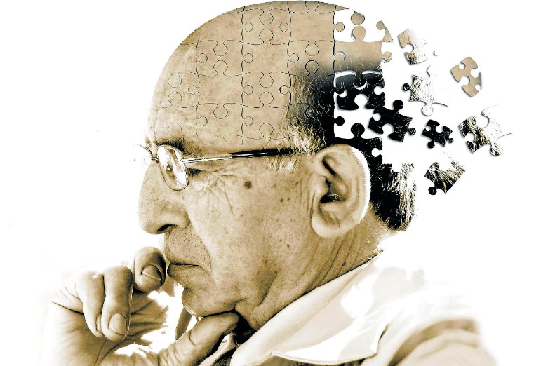 Descubren cómo se forman rápidamente en el cerebro las placas del alzheimer
