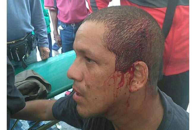 Los chavistas también le dieron duro por ese “Mango” a Oswaldo Rivero en la AN (Fotos)