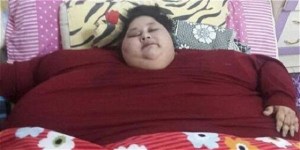 Egipcia considerada la mujer más obesa del mundo será operada en India