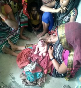 Nace bebé anencefálico en la India y los aldeanos creen que es la encarnación del Dios Mono (FOTO FUERTE)