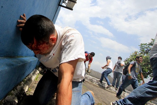 A demonstrator lies injured after riot police fired tear gas and rubber bullets at students opposing Venezuelan President Nicolas Maduro who were marching to protest in San Cristobal, Venezuela on April 5, 2017. University students and police clashed Wednesday during a protest in the Venezuelan city of San Cristobal (western border with Colombia), with a balance of at least a dozen injured. / AFP PHOTO / George Castellanos