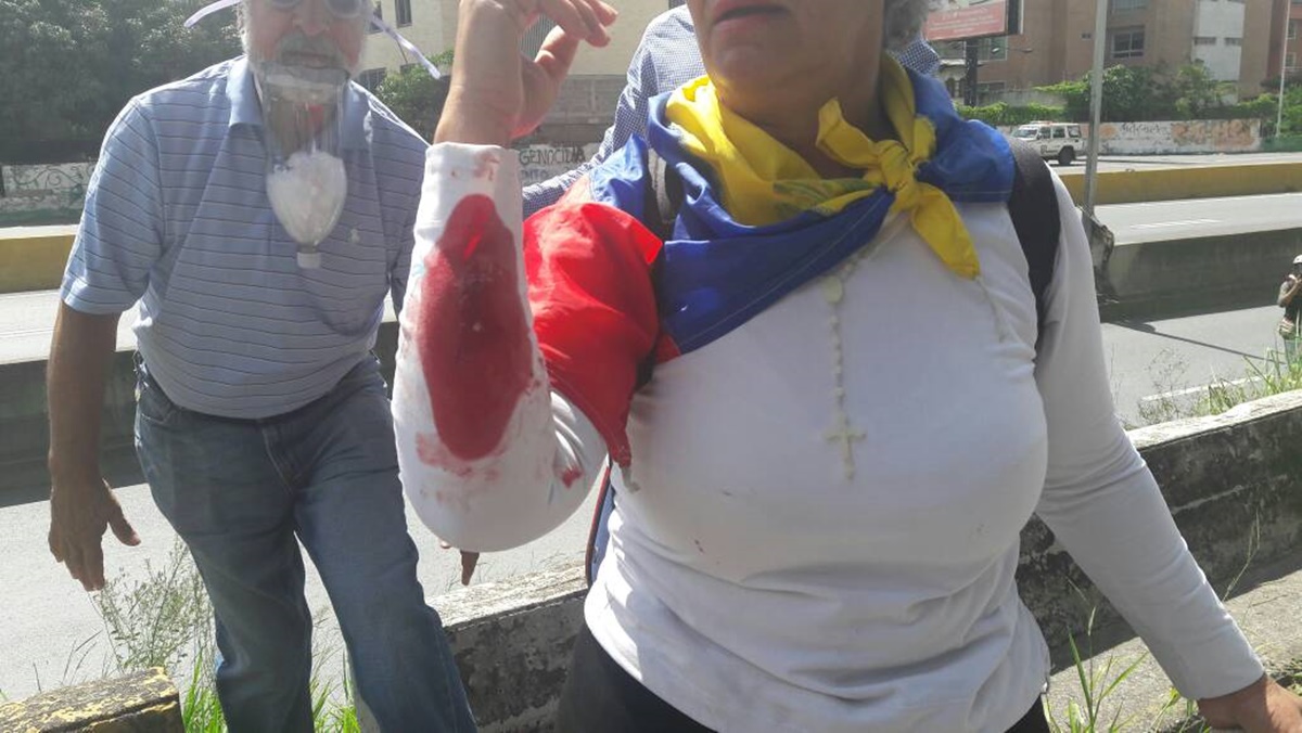 Varios heridos tras represión de la GNB en el distribuidor Santa Fe #4Ago