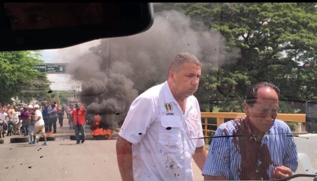 Suturan a candidato opositor en Apure tras ataque de bandas armadas, denunció Ramos Allup