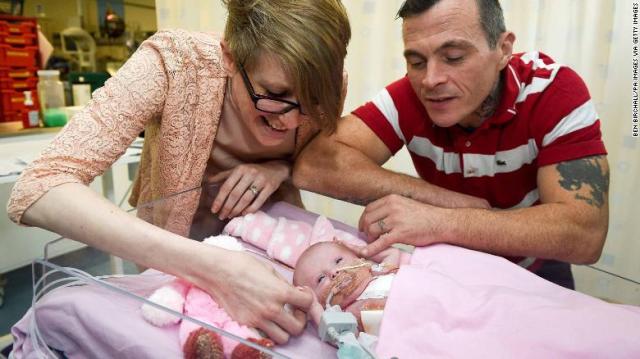 Three-week-old Vanellope Hope Wilkins, who was due to be delivered on Christmas Eve before an incredibly rare condition, in which the heart grows on the outside of the body, meant she had to be born prematurely by caesarean section on November 22, is caressed and touched by her parents Naomi Findlay and Dean Wilkins, at Glenfield Hospital in Leicester, after surviving, in what is believed to be a UK first. (Photo by Ben Birchall/PA Images via Getty Images)