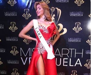¡QUÉ CAMBIO! Mira las fotos de Diana Silva, Miss Earth Venezuela 2018, antes de las operaciones