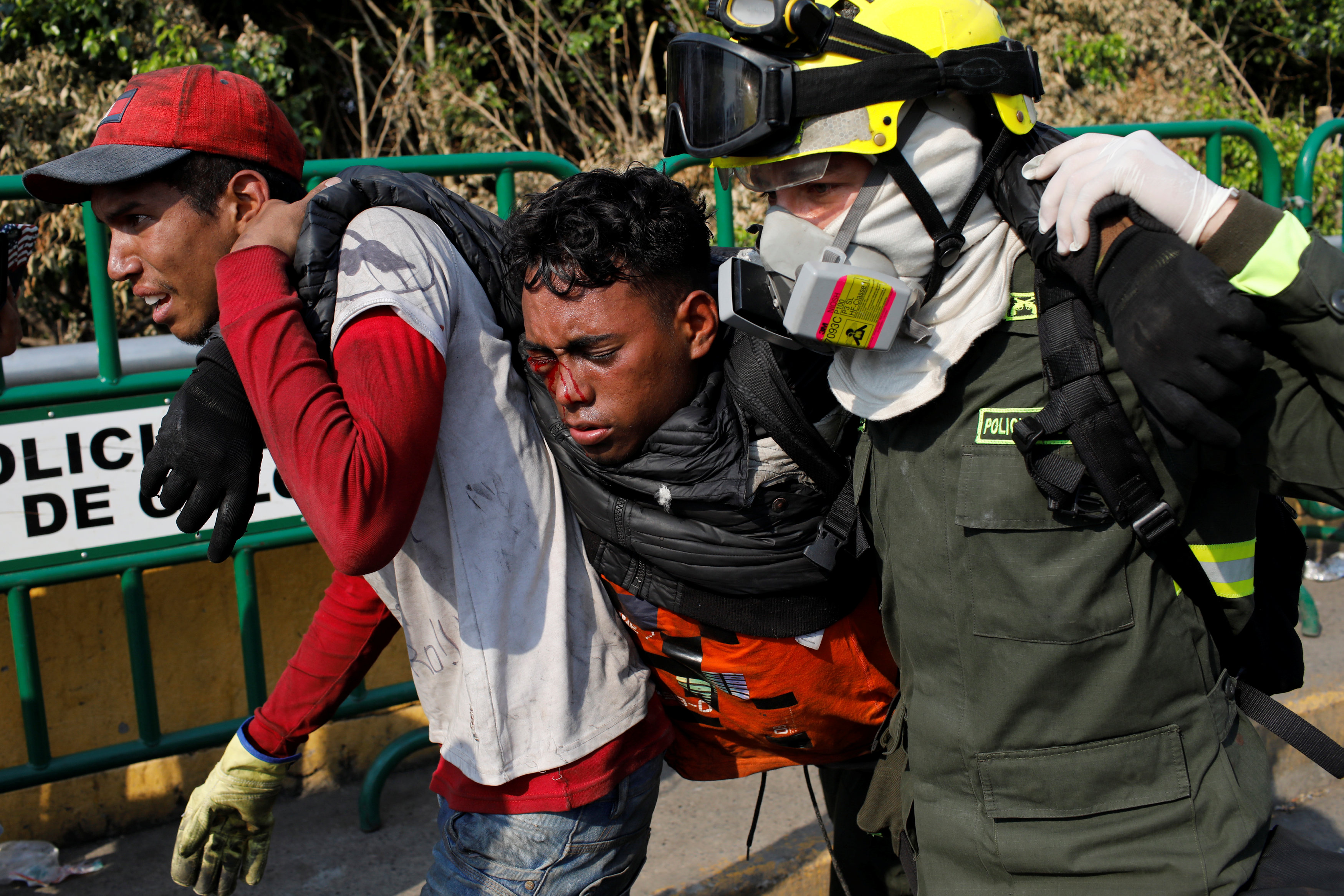 Manifestantes heridos en Puente Simón Bolívar por represión de la GNB #25Feb (FOTOS)