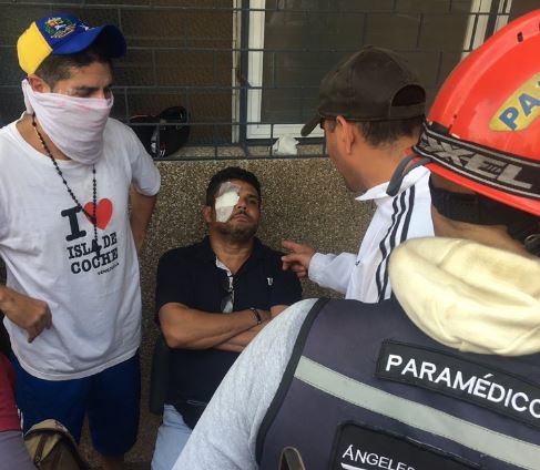 EN FOTOS: Los manifestantes heridos de perdigón atacados por la GNB en La Florida