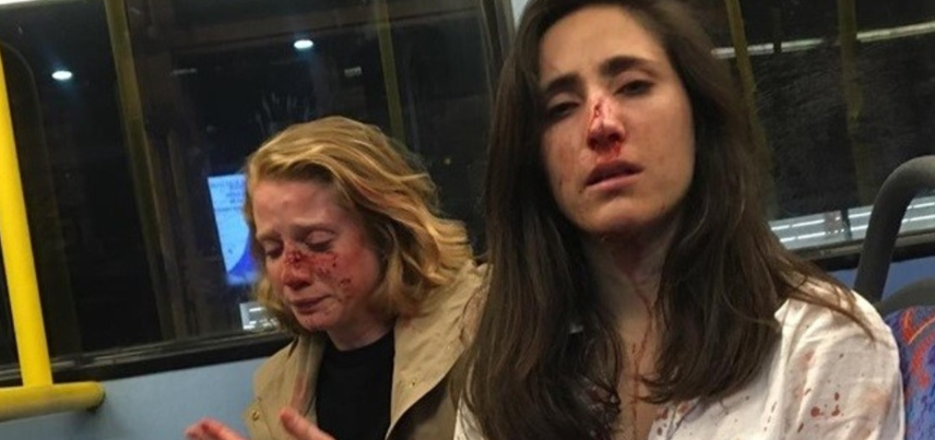 ¡Insólito! Policía otorgó libertad bajo fianza a los cinco agresores de las lesbianas en Londres