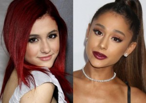 En imágenes: La cronología de las cirugías plásticas de Ariana Grande