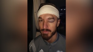 “Tu cabeza está hecha de concreto”: Jugador del Cardiff mostró el ENORME hematoma que le causó un compañero
