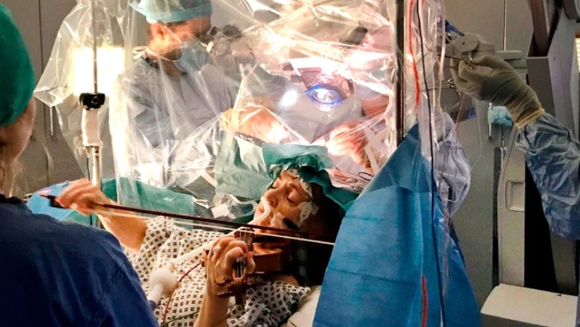 Sin palabras: Mujer toca el violín mientras que le extirpan un tumor en el cerebro (VIDEO)