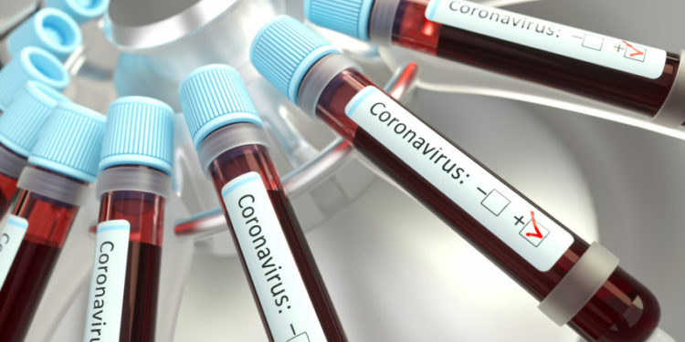 Miami tiene planes de contingencia para enfrentar el coronavirus