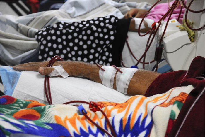 Pacientes renales del Hospital Pastor Oropeza de Barquisimeto no son dializados por falta de agua