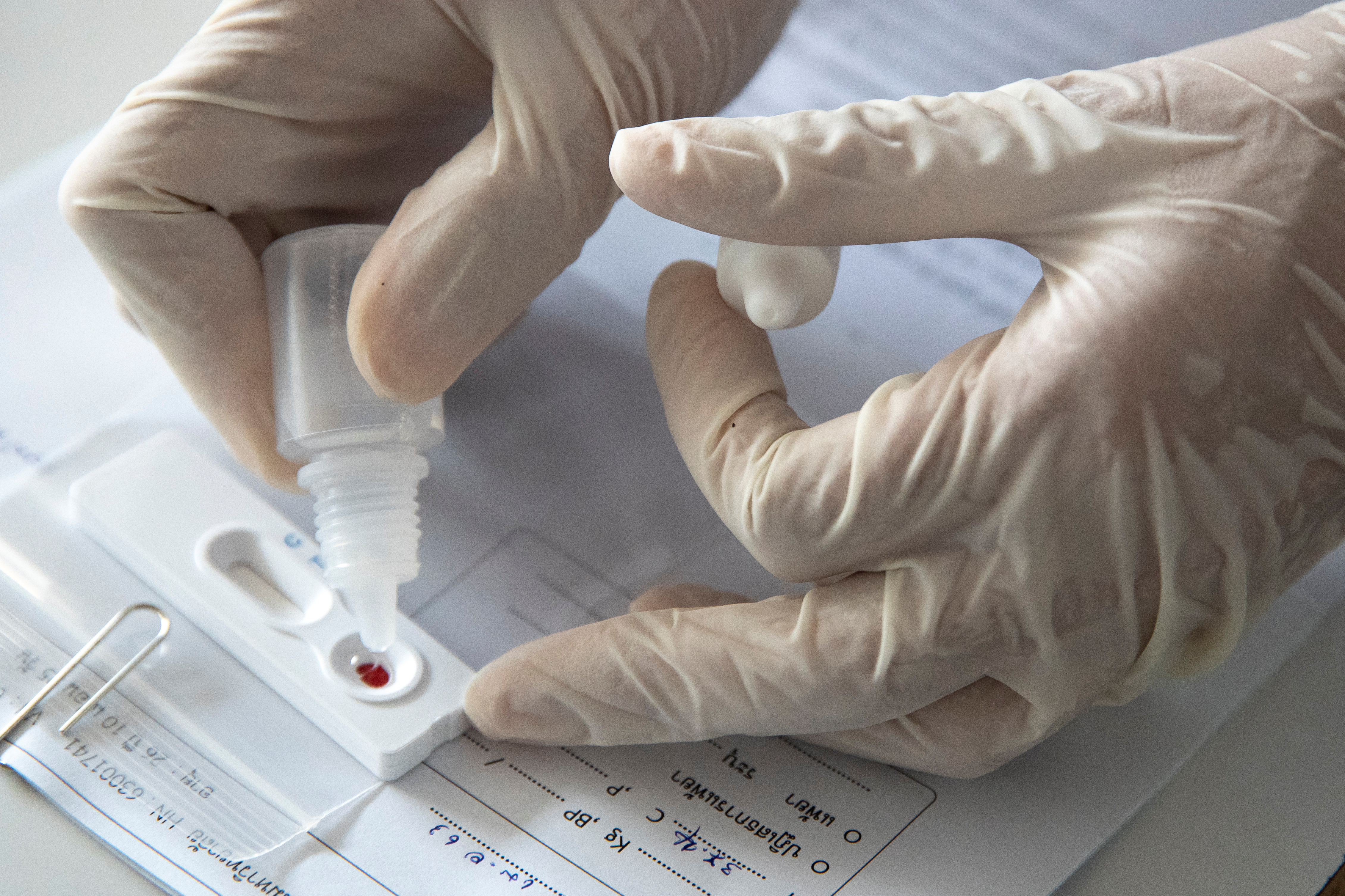 EEUU aprobó un nuevo test de coronavirus con saliva recolectada en el hogar