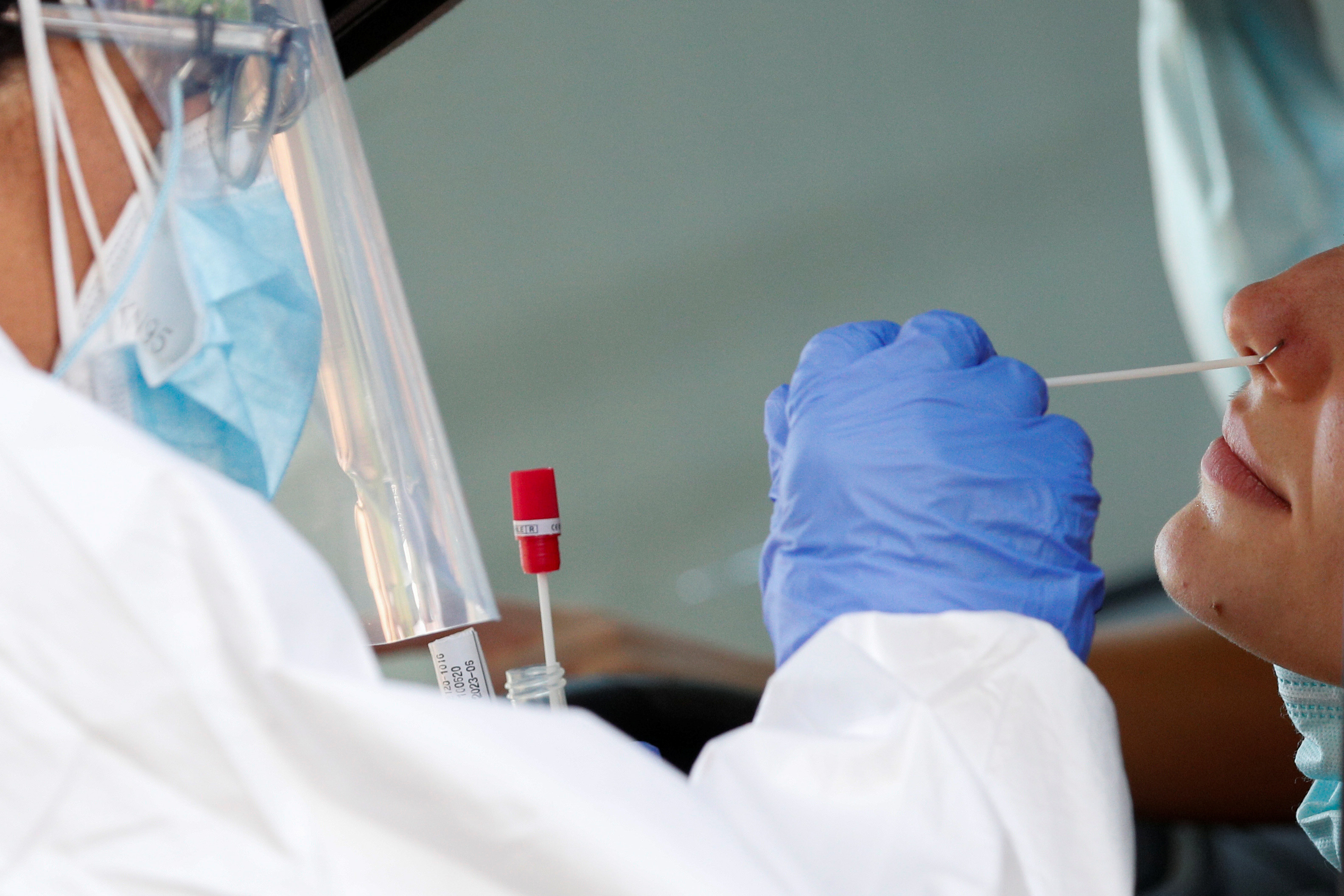 Test de sangre podría anticipar qué pacientes tendrán una evolución grave del coronavirus