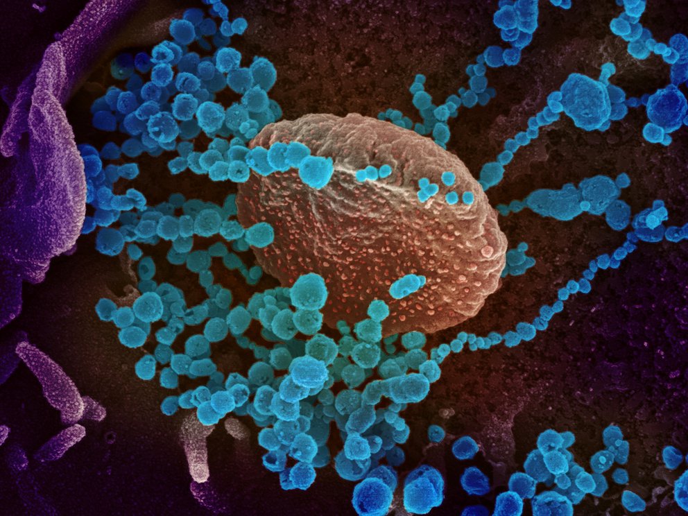 La nueva forma de transmisión del Covid-19 que daría pistas para combatir al virus