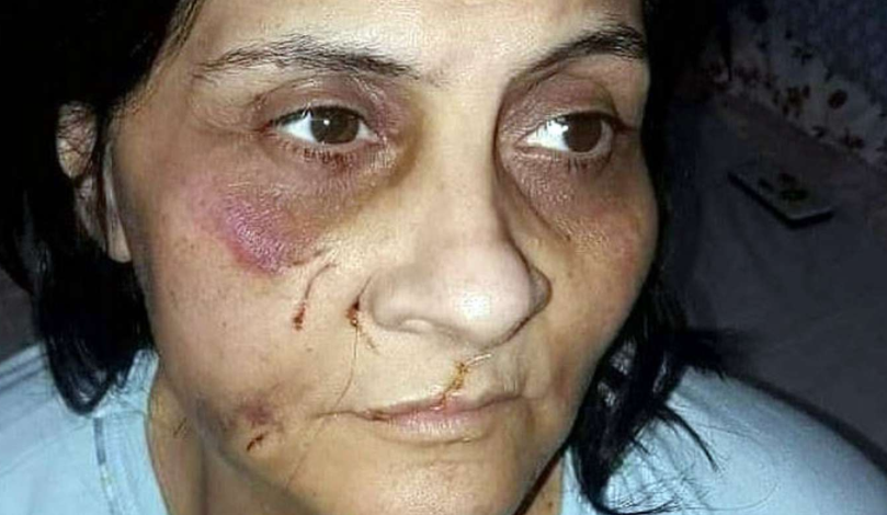 El infierno que vivió una mujer que fue apuñalada 13 veces por su pareja en Argentina