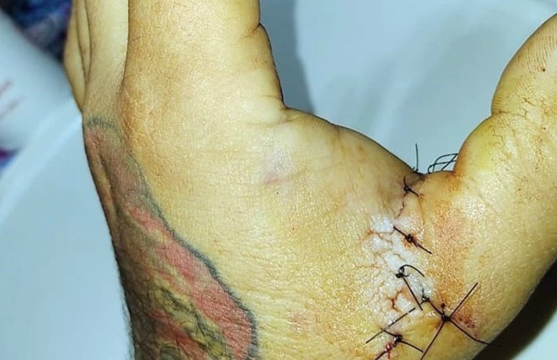 Atacó con un cuchillo al hombre que tatuó a su hija sin su consentimiento en Argentina