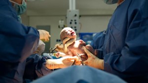Los partos por cesárea disminuyeron durante la pandemia: cuáles son las causas según los expertos