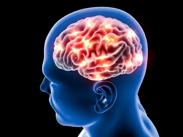 Parálisis cerebral: Causas, detección y tratamiento