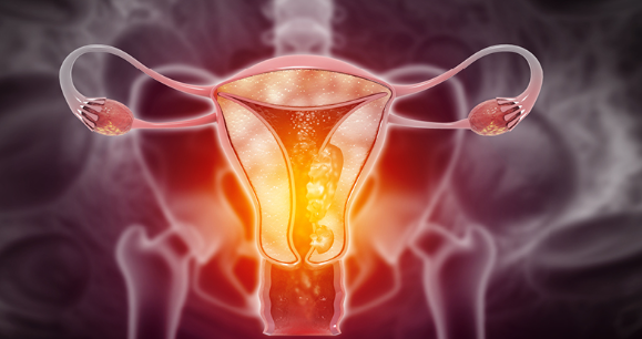 Una nueva prueba para detectar el cáncer de útero reduce la mayoría de falsos positivos