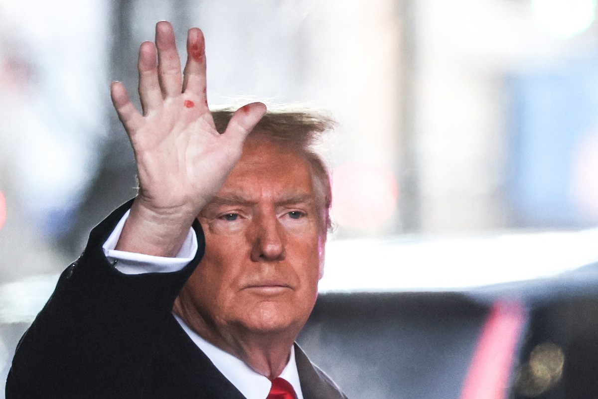 Trump se enfrenta la acusación de violación con extrañas marcas rojas en la mano (Fotos)